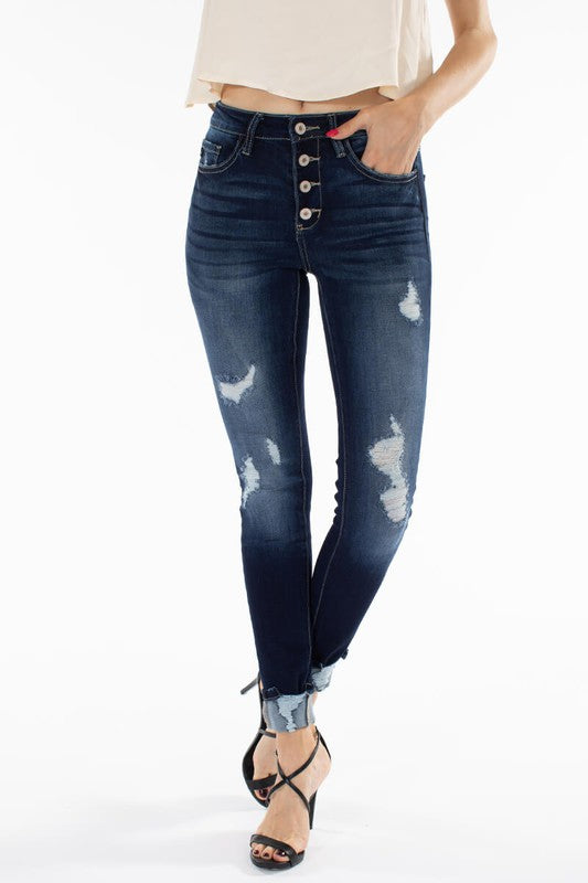 High Rise Button Fly Ankle Skinny Jeans